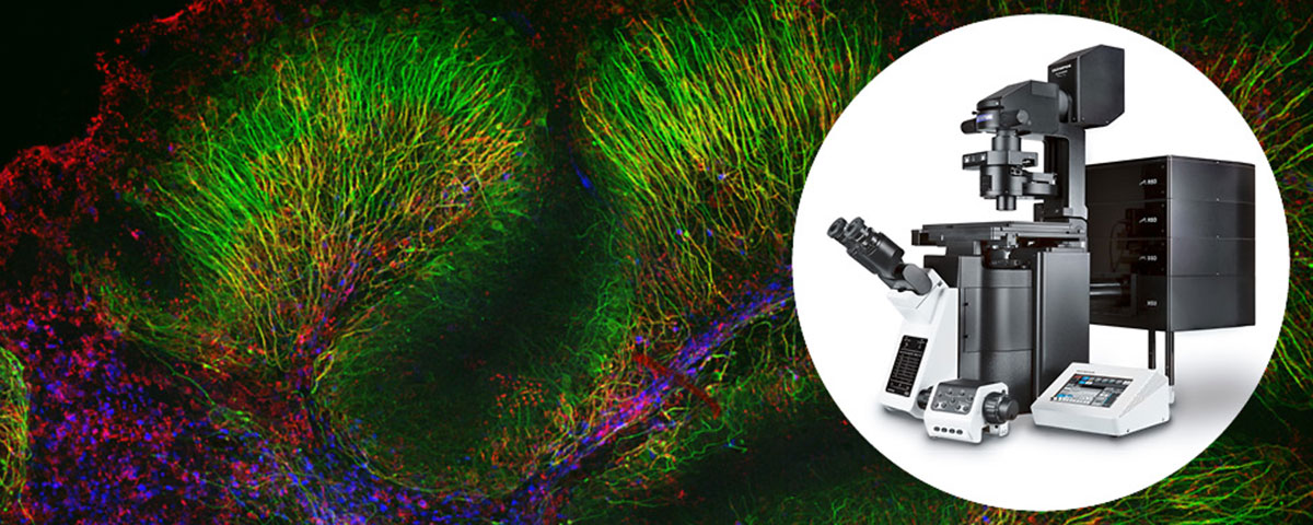 Transforming Precision Imaging